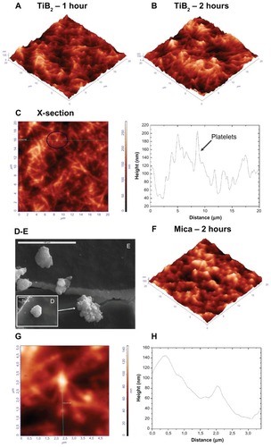 Figure 4 Atomic force microscopy (AFM) topography images of platelets on titanium (Ti) boron (B)2.13 thin films: (A) after 1 hour of incubation, the cells developed pseudopodia and formed a network; (B) after 2 hours of incubation, platelet aggregation prevailed; (C) cross section at 16.9 μm, marked with the black circle, an activated platelet with pseudopodia (left) and, marked with the lines, the platelet and plasma protein aggregated on TiB2.13 thin films (right); (D) scanning electron microscopy (SEM) image of a platelet at an early stage of activation; (E) SEM image of activated platelets that have lost their discoid shape and begun to develop pseudopodia; (F) AFM image of platelets obtained on mica after incubation for 2 hours (as control); (G) AFM image of activated platelets with filopodia (scan size of 5 × 5 μm). (H) Arbitrary cross section of an activated platelet along its pseudopodium.