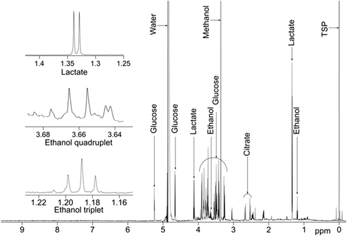 Figure 2. Example 1H NMR spectrum of CSF from an ALS patient with key metabolites identified.