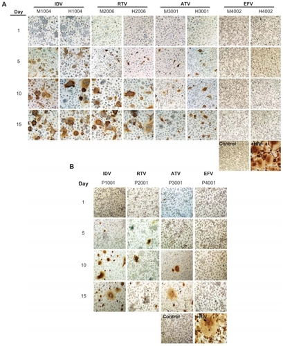 Figure 4 Antiretroviral efficacy of nanoART as determined by HIV-1p24 antigen staining.Notes: Monocyte-derived macrophages (MDM) were loaded for 8 hours with IDV, RTV, ATV and EFV nanoparticles manufactured by (A) wet milling and homogenization or (B) sonication. MDM were infected with HIV-1ADA on days 1, 5, 10, and 15 post-loading and cultured for an additional 10 days. MDM were fixed and immunostained for expression of p24. Untreated, uninfected MDM served as negative controls (control), while MDM exposed to HIV-1ADA but not treated with nanoART, served as positive controls (+HIV). Expression of viral p24 antigen was visualized by DAB chromogen (brown). Images are representative of n = 4 determinations per treatment. (Magnification, 200×).Abbreviations: IDV, indinavir; RTV, ritonavir; ATV, atazanavir; EFV, efavirenz.