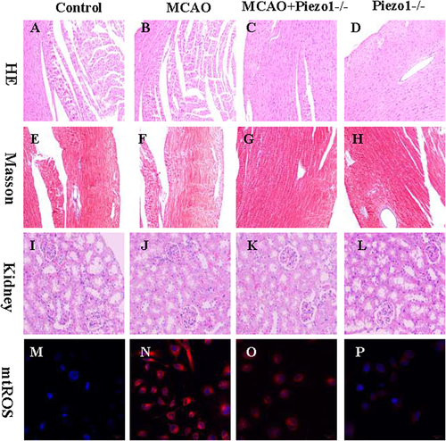 Figure 8 The knockout of Piezo1 did not induce noticeable damage to the target organs.Figures 8A-8D show the results of HE staining of myocardial tissue. Compared to the control group myocardium (A) MCAO may lead to myocardial fiber ruptures (B) while additional Piezo1 gene intervention did not affect the disrupted myocardial fiber structure (C and D). Figures 8E-8H show the results of Masson staining of heart tissue. Compared to the control group myocardium (E), MCAO may worsen myocardial cell fibrosis (F), while Piezo1 gene deletion intervention did not significantly improve the myocardial fibrosis condition (G and L). Figures 8I-8L demonstrate the results of HE staining for kidney tissue. Compared to the control group kidney tissue (I), the MCAO group kidney tissue did not show significant structural disruption (J), while Piezo1 gene deletion intervention did not exacerbate kidney damage (K and L). Figures 8M-8P illustrate the kidney oxidative stress situation. Compared to the control group (M) the MCAO group can cause an increase in kidney mtROS expression (N) and Piezo1 gene deletion intervention did not significantly improve the kidney oxidative stress situation (O and P).