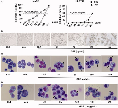 Figure 2. GSE treatment results in decreased cell growth and extensive cytoplasmic vacuolation in HepG2 cells. (A) The inhibitory effects of GSE on cell growth in HepG2 cells or normal liver epithelial cells HL-7702. Cells were treated with the indicated concentrations of GSE for 24 h, cumulative viable cells were measured by the Alamar Blue assay. Data are presented as the means ± SEM of three independent experiments. (B) Morphological alterations of HepG2 cells after treatment with GSE for 24 h by light microscopy (original magnification, ×200). (C) Morphological alterations of HepG2 cells after treatment with GSE by Wright–Giemsa staining. For dose–response experiments (C), cells were treated with GSE for 24 h. For time-course experiments, cells were treated with 100 μg/mL of GSE (D). Ctrl: control; Veh: vehicle.