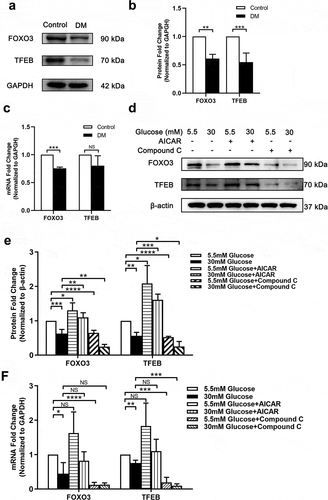 Figure 4. Down-regulated AMPK inhibits autophagy activity through inhibiting expression of FOXO3 and TFEB in LECs. (A) Proteins were extracted from the anterior capsules of DC and ARC patients (control) and then probed for FOXO3 and TFEB. GAPDH was used as a loading control. (B) Quantification of FOXO3 and TFEB expression levels in A. Fold change relative to the level of control groups is displayed. **P < .01, ***P < .001, n = 3. (C) Total RNA was extracted from the anterior capsules of DC and ARC patients (control). The mRNA levels of FOXO3 and TFEB were determined using real-time PCR and normalized to GAPDH. Fold change relative to the level of the control groups is displayed. ***P < .001, NS: not significant, n = 3. (D) SRA 01/04 were supplemented with 30 mM and 5.5 mM glucose and incubated for 48 hours. For experimental group, cells were treated with 1 mM AICAR and 10 mM Compound C for 48 hours respectively at the same time. Proteins were extracted and then probed for FOXO3 and TFEB. Without AICAR or Compound C treated LG (5.5 mM) cultured SRA 01/04 were used as control groups. β-actin was used as a loading control. (E) Quantification of FOXO3 and TFEB expression levels in D. Fold change relative to the level of control groups is displayed. *P < .05, **P < .01, ***P < .001, ****P < .0001, n = 3. (F) The mRNA levels of FOXO3 and TFEB were determined using real-time PCR and normalized to GAPDH. Fold change relative to the level of the control groups is displayed. *P < .05, **P < .01, ***P < .001, ****P < .0001, NS: not significant, n = 3