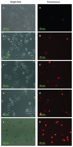 Figure 6 PTX induced morphology changes in MCF-7 cells. Cells were treated with PTX in solution or in drug-loaded micelles containing total PTX concentration of 20 nM for 48 hours. Then, PI staining assay was examined. Right panels indicate cells visualized in the fluorescence mode; left panels indicate the same fields in the bright field mode. (a) and (A) Control; (b) and (B) PTX solution; (c) and (C) Taxol; (d) and (D) DOMC/PTX; (e) and (E) DOMC-FA/PTX.Abbreviations: DOMC, deoxycholic acid-O-carboxymethylated chitosan; FA, folic acid; PI, propidium iodide; PTX, paclitaxel.