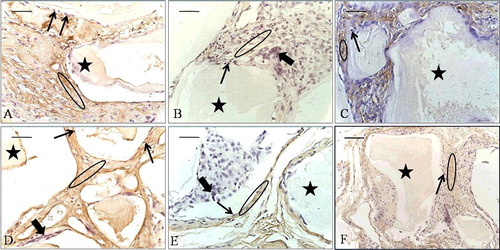 Figure 9. Osteopontin immunoexpression (ellipse) at the 2-week time point (A–C) and at the 8-week time point (D–F). EPB (A and D), PB (B and E) and B implants (C and F). Bio-Oss (star), osteoblast-like cells (long, thin arrow), multinucleated giant cells (short, thick arrow).