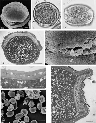 20–27. Areca klingkangensis George, S.42803, zonosulcate pollen: (20) unacetolysed pollen grain tilted, showing presumed equatorially oriented aperture, and one polar face (SEM); (21) unacetolysed pollen grain, presumed polar view, note interruptions (arrows) to sporoderm (LM); (22) unacetolysed pollen grain, presumed equatorial view (LM); (23) very oblique ultrathin section (TEM) through part of zonosulcus (top), and non-apertural exine (bottom); (24) close up to show small ektexinous “hinge” (arrow), linking the two halves of the pollen grain (SEM); (25) ultrathin section through non-apertural wall, note narrow non-acetolysis resistant dark-staining layer, underlying foot layer cf. close similarity of ectexine stratification with fig. 5 (TEM); (26) ultrathin section through zonosulcus, presumed equatorial plane, note thick and channelled intine I, and narrow, homogeneous intine II, unacetolysed (TEM); (27) group of pollen grains at low magnification to show consistency of zonosulcate condition (SEM). LM Figs.: ×1000 (in 21, 22). In SEM/TEM Figs. scale bars: 2.5 μm (in 24–26); 10 μm (in 20, 23); 25 μm (in 27).