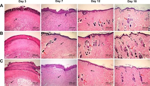 Figure 2 Wound healing histology for each group at days 3, 7, 12, and 18 after surgery.Notes: HE staining shows collagen fibers stained pale pink, cytoplasm stained purple, nuclei stained blue, and red blood cells stained cherry red. A, B, and C show gauze group, PVA/COS-AgNPs nanofiber group, PVA/COS-AgNPs nanofiber plus SB431542 group, respectively. The black and red arrows indicate blood vessels and hair follicles, respectively.Abbreviation: HE, hematoxylin–eosin.