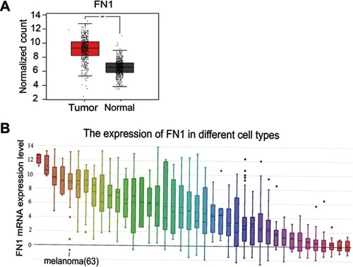 Figure S1 Clinical evidences for the overexpression of FN1 in melanoma. (A) The data from GEPIA confirmed that FN1 expression in tumorous tissues was higher than in normal non-tumorous tissues. (B) The data from the Cancer Cell Line Encyclopedia showed that FN1 was highly expressed in melanoma compared with other cell types.