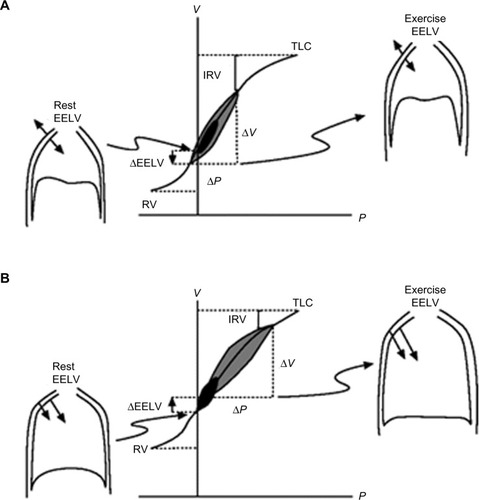 Figure 2 Pressure–volume relationships of the total respiratory system.