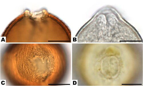 Figure 5. Apertures of Rosaceae species: A, C. Prunus sp. in acetolysed state. B. Malus-type in hydrated state. D. Prunus sp. in hydrated state. Scale bars ‒ 10 µm.