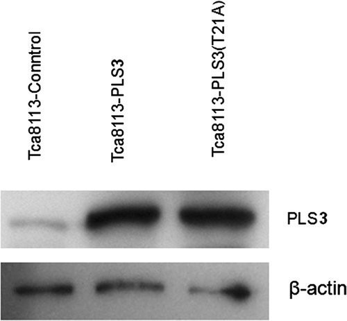 Figure 2. Tca8113 cells were transfected with the control, wild-type PLS3, and mutant PLS3 (T21A) plasmids for 24 h, respectively. Western blotting showed comparable expression of PLS3 in Tca8113- PLS3 cells and Tca8113-PLS3 (T21A) cells.