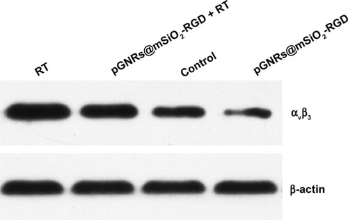 Figure 10 The effect of pGNRs@mSiO2-RGD nanoprobes on integrin αvβ3 expression as evidenced by Western blotting.Notes: MDA-MB-231 cells were incubated with pGNRs@mSiO2-RGD 24 hours prior to treatment with 6 MV X-rays (6 Gy). β-actin was used as the loading control. pGNRs@mSiO2, mesoporous silica-encapsulated gold nanorods; pGNRs@mSiO2−RGD, RGD-conjugated mesoporous silica-encapsulated gold nanorods; integrin αvβ3, integrin alphaV beta3; RGD, arginine–glycine–aspartic acid (Arg-Gly-Asp) peptides.Abbreviation: RT, radiation.