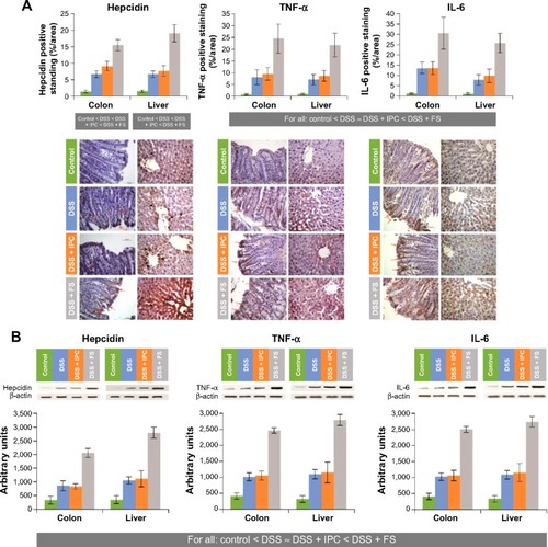 Figure 4 Expression of inflammatory markers in rat colon and liver.
