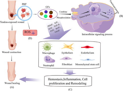 Figure 2. Mechanisms of PRP for tendon exposure wounds. PRP promotes the secretion of growth factors of PDGF, egf other growth factors. At the same time, it inhibits the inflammatory response and reduces the production of local ROS. Finally, these cytokines act on MSCs, macrophages fibroblasts, etc., and ultimately promote wound healing by means of inflammatory responses, proliferation and remodeling.