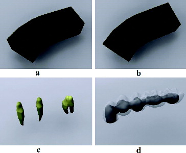 Figure 2. Computer-aided models. (a) Implant slots opened on computer-aided designed bone models; (b) tooth slots opened on computer-aided designed bone models; (c) computer modelling of restorations; (d) computer modelling of zirconia frameworks and veneer sheets.