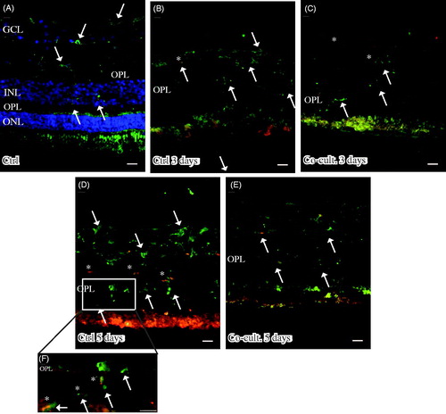 Figure 4. Immunofluorescent staining for C1q (red) and the microglial marker ionized calcium binding adaptor molecule 1 (IBA-1, green) in retinal tissue and ARPE cells. The non-cultured control retina (A) is counterstained with DAPI, and the nuclear layers are indicated: outer, inner, and inner ganglion cell layer (ONL, INL, and GCL), respectively, as well as the outer plexiform layer (OPL). C1q is not shown in non-cultured control retinal cells (A). Resident microglial cells (A) located in the inner retinal tissue (indicated by arrows) and microglial protrusions extend all the way to the OPL (indicated by arrows in the OPL) in the non-cultured control tissue. After 3 days in culture the migrating and active amoeboid-like microglial cells (indicated by arrows) become sparsely C1q-expressing (indicated by *). After 5 days in culture, active microglial cells start to migrate even more, through the OPL and into the outer retinal tissue (D–F). Active microglial cells in retinal tissue cultured for 5 days (D and F) are double-labeled with anti-C1q. There seem to be more active and C1q-positive microglial cells (indicated by *) in the cultured specimens (D, F) than in the co-cultured specimens (E) after 5 days. Scale bars, 20 μM.