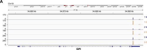 Figure 5 GPI preferentially use proximal APA in cancer samples.