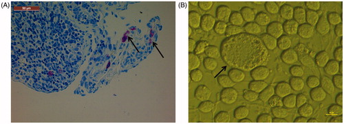 Figure 1. Pictures of mediator release of mouse mast cells and RBL cells (arrows). (A) Mast cells in small intestine of Balb/c mice stained with toluidine blue for microscopic examination (Type DM 1000, Leica, Geneva, Switzerland). (B) RBL cells examined by fluorescent inverted microscope (Type TH4-200, Olympus, Tokyo, Japan).