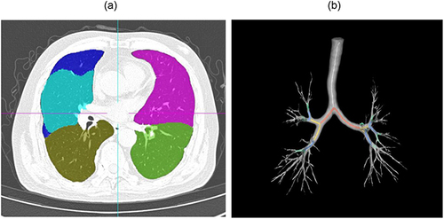 Figure 2 Labeled lung lobe and airway tree.