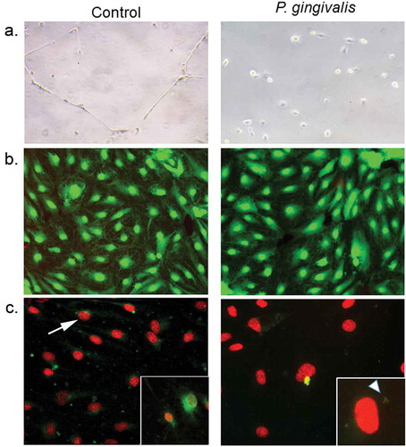 Figure 6. Impact of P. gingivalis infection on HD-MVEC network formation (a), viability (b), and apoptosis(c). (a) HD-MVEC network formation on Matrigel after 24 h. (b) HD-MVEC viability (green) assessed with LIVE/DEAD® Viability/Cytotoxicity Kit, dead cells are labelled red. (c) Apoptosis detected by activation of caspase 3/7 (green, white arrow) as shown in the magnified inset in control panel, which is an H2O2 positive control (arrow). Magnified inset in (c) P. gingivalis panel shows internalized bacteria (white arrowhead) confirming that cells were infected