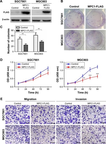 Figure 4 Overexpression of MPC1 attenuated the proliferative, migrating, and invasive abilities of human GC cells.