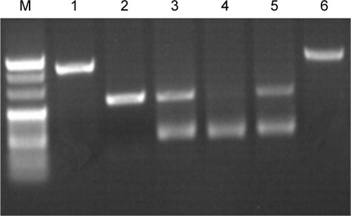 Figure 1 P2Y12 gene electrophoretogram.