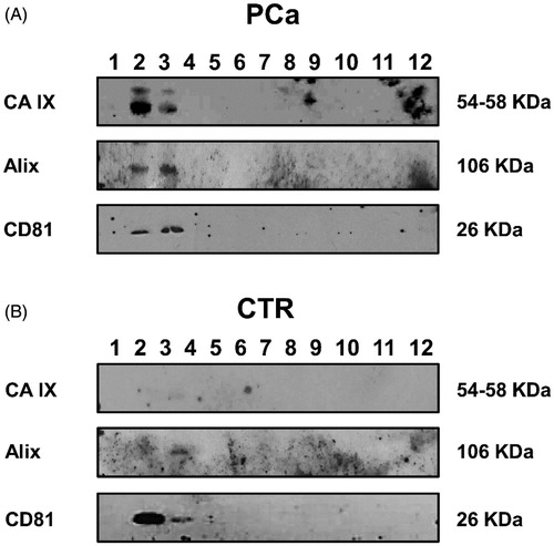 Figure 2. Western blot analysis of plasmatic exosomes from PCa patients and CTR after 30% sucrose density gradient ultracentrifugation for housekeeping markers (Alix and CD81) and CA IX expression. (A) Protein characterisation of exosomal fractions purified from plasma of PCa patients performed with anti-Alix, anti-CD81 and M75 (CA IX). (B) Protein characterisation of exosomal fractions purified from plasma of CTR performed with anti-Alix, anti-CD81 and M75 (CA IX).