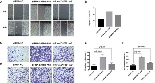 Figure 9. Downregulated SATB1-AS1 or ZNF561-AS1 contributes to the EMT process in LSCC.Wound healing assay was performed in SNU1066 cells transfected with siRNA-NC (siRNA-negative control), siRNA-SATB1-AS1 or siRNA-ZNF561-AS1 (A). The migration rate in the wound healing assay (B). Transwell migration assay (C) and the corresponding migrated cell numbers (E) after siRNA transfection. Transwell invasion assay (D) and the corresponding invaded cell numbers (F) after SNU1066 cells were transfected with siRNA-NC, siRNA-SATB1-AS1 or siRNA-ZNF561-AS1.