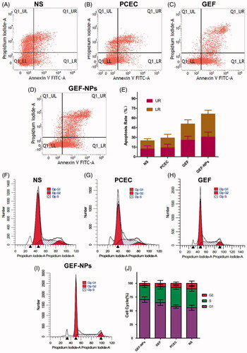 Figure 3. The tumor tissue apoptotic distribution (A–E) and cell-cycle distribution (F–J): (A–D): tumor tissue apoptotic distribution of different therapeutic effects on A549 tumor-bearing nude BALB/c mice; (E) Quantitative analysis of the proportion of cells in each group tumor tissue apoptotic distribution. (F–I): cell-cycle distribution of different therapeutic effects on A549 tumor-bearing nude BALB/c mice; (J): Quantitative analysis of the proportion of cells in each group cell-cycle distribution.