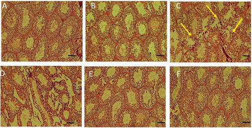 Figure 2. Histological examinations of tubules in the testis of (A) control, (B) sham (RD40), (C) FA, (D) RD10 + FA, (E) RD20 + FA and (F) RD40 + FA groups. Abnormal and barren testicular seminiferous without spermatozoa were observed in germinal epithelium of FA group. In FA and RD + FA groups, the diameters of testicular seminiferous and epithelial tubules significantly decreased compared to the control group. However, in the ‘FA + RD’ groups, the diameters of seminiferous and epithelial tubules increased compared to the FA group. Scale bar =100 µm.