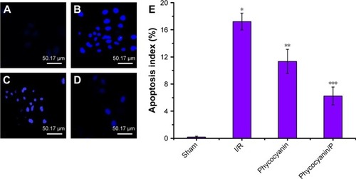 Figure 8 Apoptosis evaluation.Notes: (A–E) The islet tissues of Sham, I/R, phycocyanin and phycocyanin/PEG-b-(PG-g-PEI) groups of rats were collected 12 hours after reperfusion and the apoptosis measured. Results are expressed as mean ± SD. *Significant increase from the Sham group (P<0.01). **Significant decrease from the I/R group (P<0.01). ***Significant decrease from the I/R group (P<0.01).Abbreviations: I/R, ischemia/reperfusion; PEG-b-(PG-g-PEI), poly(ethylene glycol)-b-(poly(l-glutamic acid)-g-polyethylenimine).