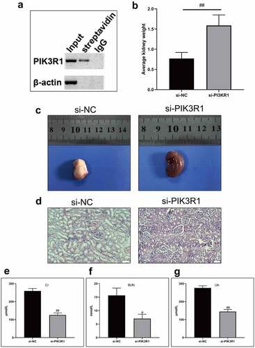 Figure 5. Quercetin treats CRF by regulating PIK3R1. A, PIK3R1 results by western blot after biotin-labeled Quercetin incubated with total kidney protein. B-C, Average weight and appearance of rat kidney after interfering PIK3R1. From left to right, the model group+si-NC, the model group+si-PIK3R1 group. D, HE staining. E, Content of Cr. F, Content of BUN. G, Content of UA. #, p < 0.05. ##, p < 0.01