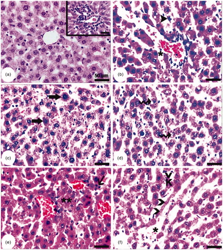 Figure 1. Representative liver section light microscopy photographs. Sections of livers from control (a) and LF treated (b–f) adult rats. Thick arrowhead: smaller cells with eosinophilic cytoplasm and damaged nuclei; asterisk: dilated sinusoid; thick arrow: giant hepatocytes; waved arrows: peri-nuclear and cytoplasmic vacuoles; double asterisks: cellular debris; K: Kupffer cell; thin arrowhead: thinned hepatocyte cords. Eosinophilic-dyed infiltrates can be seen in (e); (a) shows a portal area structure in livers of control rats. Scale = 50 µm.