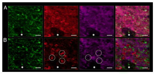 Figure 6. Post-acquisition spectral unmixing improves contrast of tricolor TPE images. Tricolor images of RBCs (green) and neutrophils (red) in the pulmonary microcirculation (purple) of a live C57BL/6 mouse (A) before spectral unmixing and (B) after spectral unmixing performed with NIS Elements software. The green channel shows RBCs stained with iv administration of FITC Ter-119 mAb. Spectral unmixing has served to reduce some tissue autofluorescence in the green channel, visible as a green haze in the original image A. The red channel shows neutrophils stained with iv administration of Alexa Fluor 546 Gr-1 mAb. The red channel also includes substantial bleed through from the intravascular fluorochrome (far red channel; purple) in the original image A. Spectral unmixing partially eliminates the bleed through, enabling visualization of neutrophils (red). After spectral unmixing, neutrophils appear as dark objects on a purple background far red (purple) channel. Three characteristic neutrophils are marked by the dotted circles. The merged tricolor images show that spectral unmixing leads to an improvement in visualization of both intravascular RBCs and neutrophils. Alveoli are marked by asterisks. Scale bars are 20 µm.