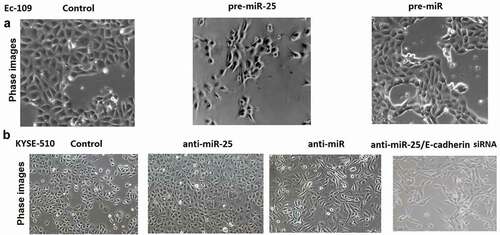 Figure 5. Down-regulation of miR-25 or up-regulation of miR-25 in cells having undergone EMT.