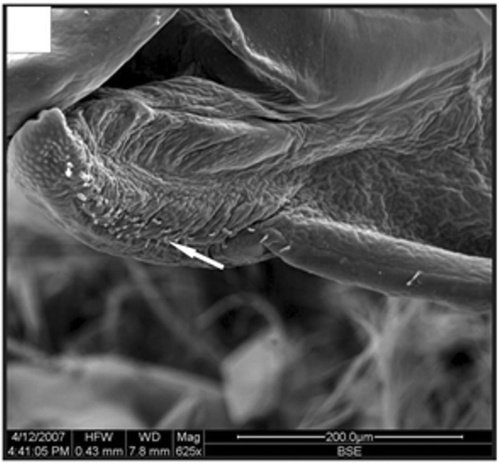 Figure 18. Detail of a petasma of a specimen with 10.1 mm CL. Cincinnuli (arrow). Scale bar = 200 µm.