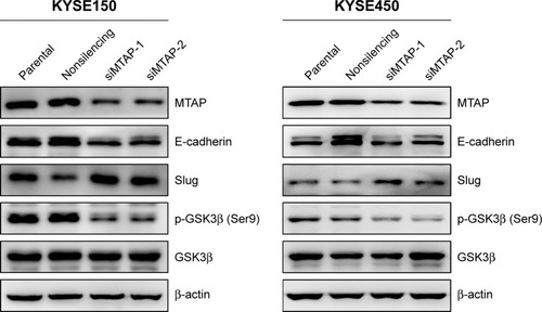 Figure 4 MTAP knockdown regulated the expression of proteins related with cell motility in ESCC.
