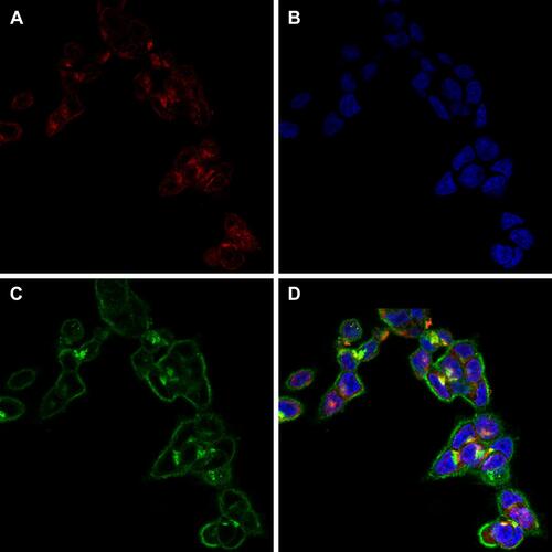 Figure 16 Colocalization of (A) clathrin, (B) nucleus, (C) nanoparticles, and (D) merged photographs in HT-29 cells.