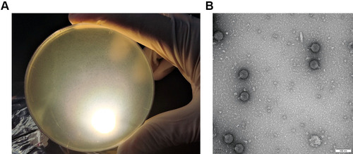 Figure 1 (A) Plaques of phage vB_PaeP_PA01EW on P. aeruginosa PA01. (B) Morphology of phage vB_PaeP_PA01EW.