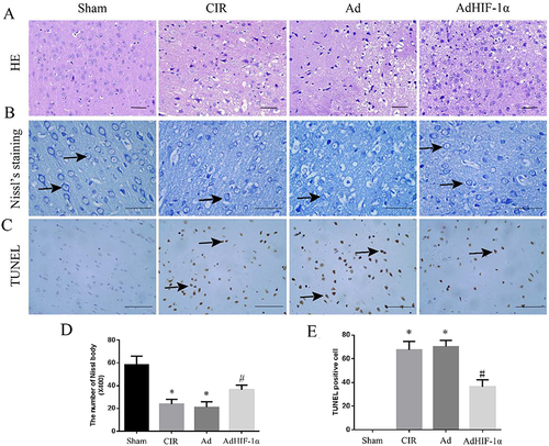 Figure 3 HE staining, Nissl staining and TUNEL staining. (A) HE staining of the ischemic penumbra in each group (scale bar=50mm); (B) Nissl staining in each group (→shows Nissl staining positive cells; scale bar=50mm); (C) TUNEL staining in each group (→shows apoptotic cells; scale bar=50mm); (D) Statistical analysis of the number of Nissl staining positive cells in rats; (E) Statistical analysis of apoptotic neuronal cells in rats. *P < 0.05 vs Sham group; #P < 0.05 vs CIR group or Ad group.