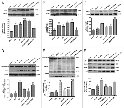 Figure 4. 3-MA decreased HSP60 and GRP78 expression, while increasing CHOP, caspase-12 and caspase-3 expression in a rat model of ischemic preconditioning. Rats were treated with a single i.c.v. of 3-MA 200 nmol 5 min before the onset of IPC (10 min MCA occlusion). A lethal ischemia was induced by PFI. Rats were killed 24 h after ischemia. Extracts from the ischemic and sham-operated cortex were separated on SDS-PAGEL and protein levels were detected with immunoblotting. Levels of β-actin protein were used as the loading control. Quantitative analysis was performed with Sigma Scan Pro 5. (A) Protein expression of HSP60. (B) Protein expression of GRP78. (C) Protein expression of CHOP. (D) Protein expression of caspase-12. (E) Protein expression of caspase-3. (F) Protein expression of P-eIF2α and eIF2α. Bar represents mean ± SD, n = 6. *p < 0.05, **p < 0.01 compared with the sham-operated group; #p < 0.05, ##p < 0.01 compared with the PFI group; $p < 0.05, $$p < 0.01 compared with the vehicle+IPC+PFI group.