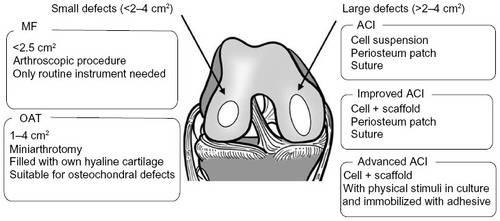 Figure 1 Treatment criteria, technical significance, and benefits.