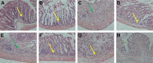 Figure 6 Pathological analysis of colon tissues after distinct treatments using H&E staining assay, magnification =100×. (A) Normal control, (B) CA/BaSO4 microcapsule treatment, (C) DSS induction, (D) sulfasalazine treatment after DSS induction, (E) 0.6×109 Bifidobacterium-loading CA/BaSO4 microcapsule treatment after DSS induction, (F) 1.2×109 Bifidobacterium by microcapsule treatment after DSS induction, (G) 2.4×109 Bifidobacterium by microcapsule treatment after DSS induction, (H) 2.4×109 Bifidobacterium treatment after DSS induction. The blue circles denote infiltration of mononuclear, submucosal lymphoid hyperplasia, and extension around intestinal glands; yellow arrows denote the distortion of crypts and loss of goblet cells; the green arrows denote the severe mucosal damage in the colon.Abbreviations: CA/BaSO4, chitosan-coated alginate microcapsule loaded with in situ synthesized barium sulfate; DSS, dextran sulfate sodium.