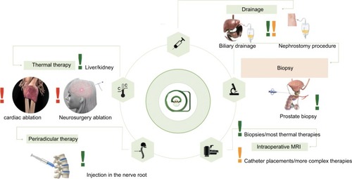 Figure 7 Possible therapies for the Interventional US/MRI fusion procedure setup.