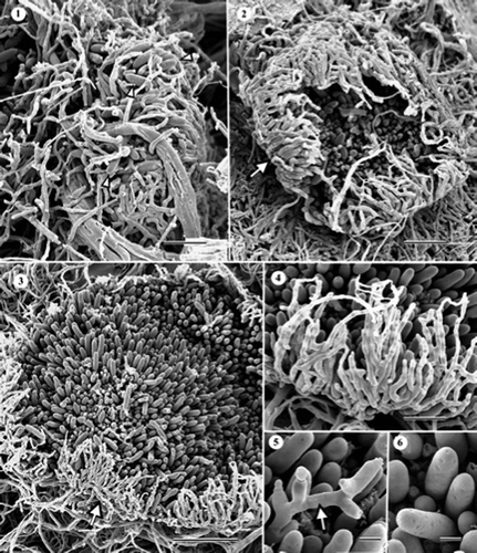 Figures 1–6. Scanning electron micrographs of Cryptosporiopsis brunnea (ex-type, UAMH 10106) on MEA after 1 month at 22 °C. (1) Immature conidioma containing a few macroconidia (arrowheads). (2) Near mature conidioma with an opening, excipular covering tissue (arrow). (3) Fully expanded conidioma exposing the conidiogenous layer with numerous macroconidia. The arrow indicates the excipular hyphae. (4) Enlarged view of sterile excipular hyphae. (5) More or less alternately proliferated macroconidiogenous cells (arrow). (6) Smooth and pitted macroconidia. Bars = 40 μm (Figure 1); 20 μm (Figures 2 and 4); 30 μm (Figure 3); 6 μm (Figures 5 and 6).