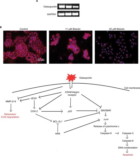 Figure 6 (A) The gene expression analysis of osteopontin in response to the treatment with betulin after 48 hours as observed via RT-PCR. The results show pronounced downregulation of expression of the marker in comparison to GAPDH, the reference gene. (B) Proteomic analysis of osteopontin compared with the untreated control studied through immunofluorescence assay under fluorescent microscope at 20× magnification. The expression of osteopontin in the cells after the treatment. (C) Proposed mechanism of osteopontin as central regulator of apoptosis and metastasis in H460 cells.Abbreviation: MMP, matrix metalloproteinases.