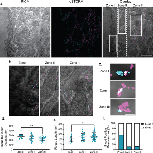 Figure 5. Changing architecture is consistent in migrating cells. (a) The left panel shows a representative RICM image of the scratch, the middle panel shows a two-color dSTORM image of desmosomes at the scratch (magenta: desmoplakin, cyan: E-cadherin), and the right panel shows the overlay of the RICM and dSTORM images. Desmosomes at the first half of the cells at the leading edge of the scratch are defined as Zone 1, the back half of the same cells are defined as Zone 2, and cells behind the leading edge are defined as Zone 3. (b) depicts a representative zoomed in the area of each Zone. (c) depicts a representative single desmosome from each corresponding zone. Quantification of plaque-to-plaque distance (d), plaque length (e), and percent E-cad-positive desmosomes (f) for each zone. (Zone I n = 16, Zone II n = 34, and Zone III n = 47). Scale bar = 5 μm (A) 0.25 μm (b,c). * P ≤ .05, ** P ≤ .01 by ANOVA with post hoc Tukey’s test.