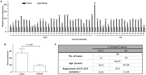 Figure 1. CCAT1 is upregulated in cervical cancer tissues. (a) The relative expression of CCAT1 in 50 cervical cancer tissues compared with their adjacent normal cervical tissues. N.S., not significant; *P < 0.05, **P < 0.01. (b) The expression of CCAT1 in the cervical cancer tissues compared with the normal cervical tissues. The expression level of CCAT1 was normalized to GAPDH. (c) Statistical analysis of clinical data. SCC, squamous cell carcinoma; AC, adenocarcinoma.