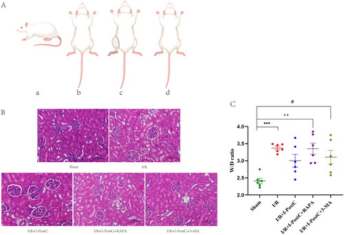 Figure 1. Schematic diagram of the rat model establishment (A). Normal rat (a); rat under anesthesia (b); rat in the state of limb ischemia, the blood flow of the right hind limb was blocked by a self-locking nylon band (width 5 mm) above the trochanter (c); rat in the state of limb ischemia–reperfusion, the nylon band was removed after ischemic intervention (d). Morphological features evaluated by H&E staining (×200) and W/D ratio of the kidneys in different groups (B, C). Sham group, normal glomeruli and tubules; I/R group, segmental renal tubular epithelial edema, lumen narrowing, and local glomerular atrophy; I/R + I-PostC group, mild edema of renal tubular epithelial cells and local lumen stenosis; I/R + I-PostC + RAPA group, extensive glomerular atrophy with mild to moderate tubular stenosis; I/R + I-PostC + 3-MA group, slight edema of tubular epithelial cells. (C) ***p<.001, I/R vs. sham; ++p<.01, RAPA vs. I/R; #p<.05, 3-MA vs. I/R.