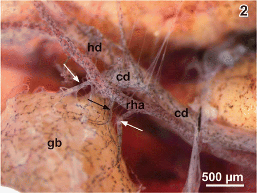 Figure 2. Arterial supply of the gallbladder (gb). Note the cystic arteries (arrows) arising from the right hepatic artery (rha). cd cystic duct, hd hepatic duct.