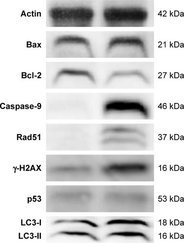 Figure 7 Assessment by Western blotting.Notes: The SKOV3 cells were treated with ZnO NPs (30 μg/mL) for 12 h and the expression analysis of Bax, Bcl-2, caspase-9, Rad51, γ-H2AX, LC3, and p53 was performed by Western blot analysis. Data are presented from three independent experiments.Abbreviation: ZnO NPs, zinc oxide nanoparticles.